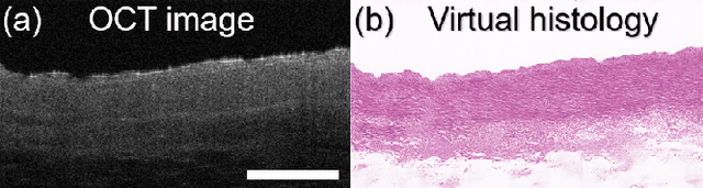 Figure 1 for Structural constrained virtual histology staining for human coronary imaging using deep learning