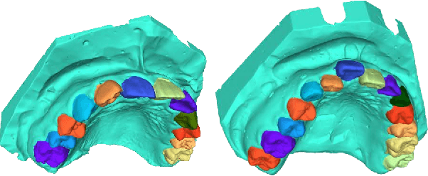 Figure 3 for An Implicit Parametric Morphable Dental Model