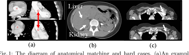 Figure 1 for SAM++: Enhancing Anatomic Matching using Semantic Information and Structural Inference