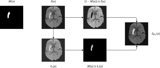 Figure 1 for Local Gamma Augmentation for Ischemic Stroke Lesion Segmentation on MRI