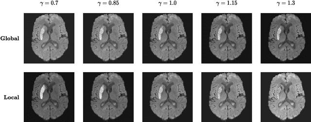 Figure 3 for Local Gamma Augmentation for Ischemic Stroke Lesion Segmentation on MRI
