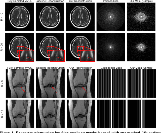 Figure 1 for Optimizing Sampling Patterns for Compressed Sensing MRI with Diffusion Generative Models
