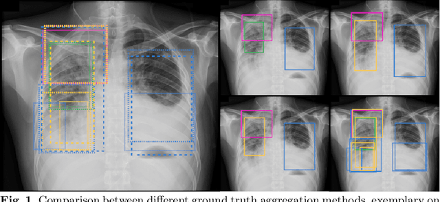Figure 1 for Drawing the Same Bounding Box Twice? Coping Noisy Annotations in Object Detection with Repeated Labels