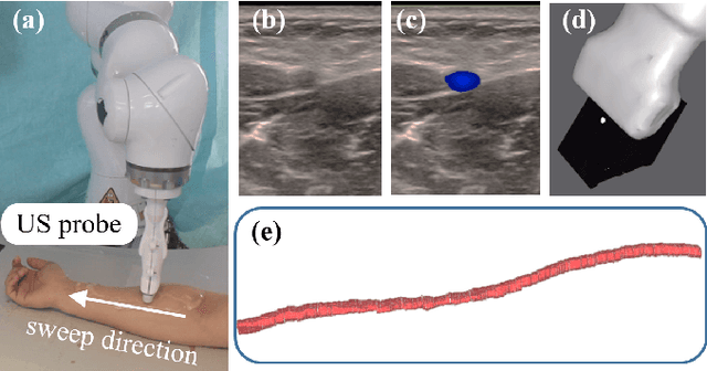 Figure 1 for DopUS-Net: Quality-Aware Robotic Ultrasound Imaging based on Doppler Signal