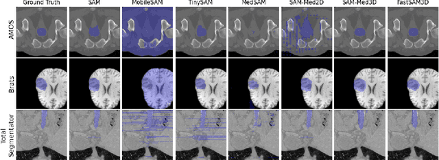 Figure 4 for FastSAM3D: An Efficient Segment Anything Model for 3D Volumetric Medical Images