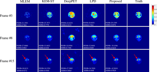 Figure 2 for STPDnet: Spatial-temporal convolutional primal dual network for dynamic PET image reconstruction