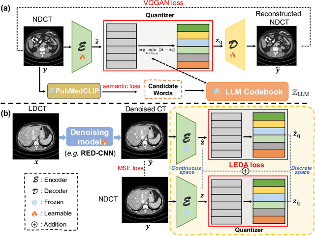 Figure 1 for Low-dose CT Denoising with Language-engaged Dual-space Alignment