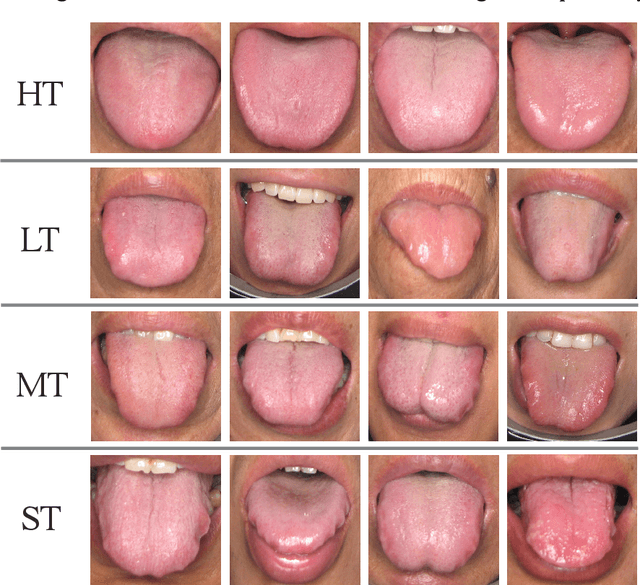 Figure 1 for Ammonia-Net: A Multi-task Joint Learning Model for Multi-class Segmentation and Classification in Tooth-marked Tongue Diagnosis