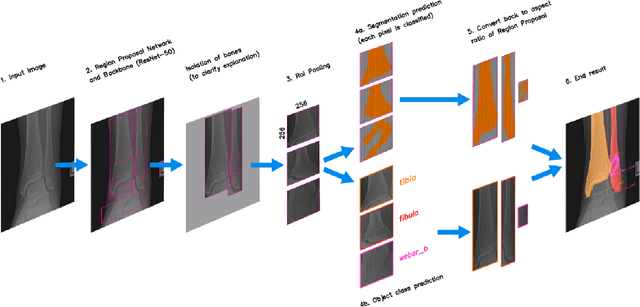 Figure 2 for A multi-stage semi-supervised learning for ankle fracture classification on CT images