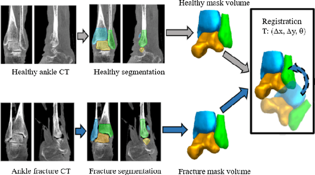 Figure 3 for A multi-stage semi-supervised learning for ankle fracture classification on CT images