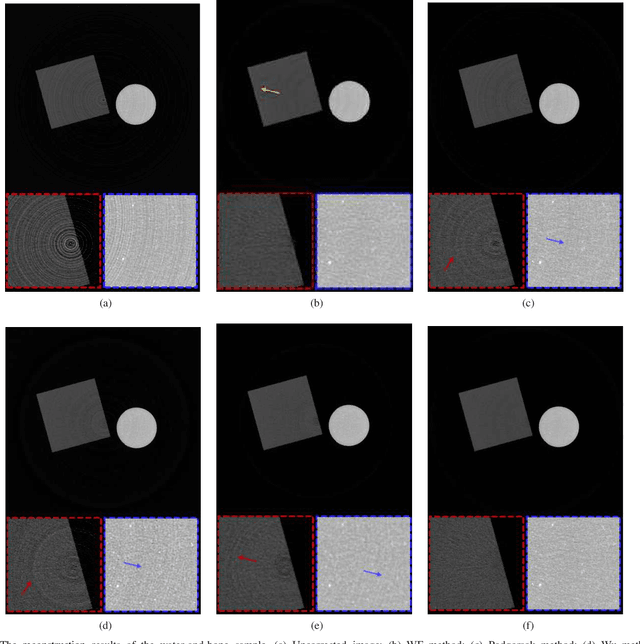 Figure 3 for A Dual-domain Regularization Method for Ring Artifact Removal of X-ray CT