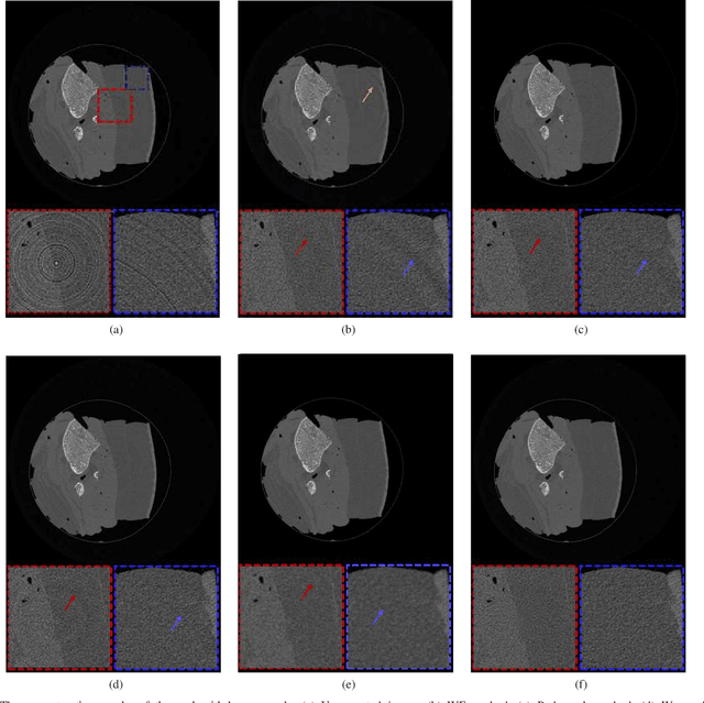 Figure 4 for A Dual-domain Regularization Method for Ring Artifact Removal of X-ray CT