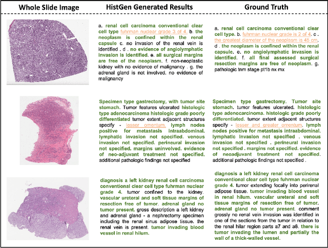 Figure 4 for HistGen: Histopathology Report Generation via Local-Global Feature Encoding and Cross-modal Context Interaction