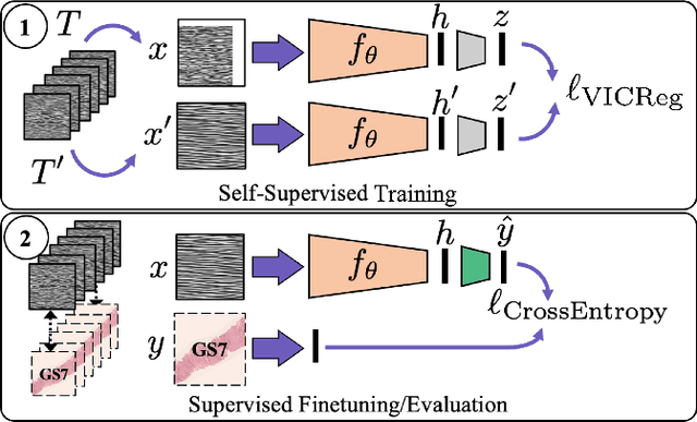 Figure 2 for Self-Supervised Learning with Limited Labeled Data for Prostate Cancer Detection in High Frequency Ultrasound