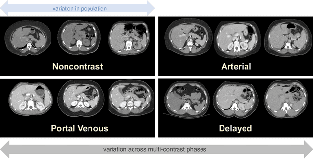 Figure 1 for Multi-Contrast Computed Tomography Atlas of Healthy Pancreas