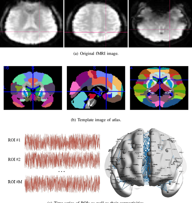 Figure 1 for TiBGL: Template-induced Brain Graph Learning for Functional Neuroimaging Analysis