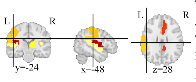 Figure 3 for TiBGL: Template-induced Brain Graph Learning for Functional Neuroimaging Analysis