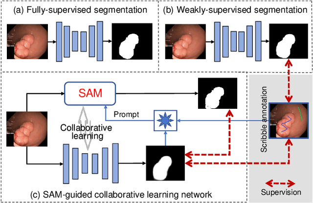 Figure 1 for Segment Anything Model-guided Collaborative Learning Network for Scribble-supervised Polyp Segmentation