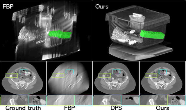 Figure 1 for DOLCE: A Model-Based Probabilistic Diffusion Framework for Limited-Angle CT Reconstruction