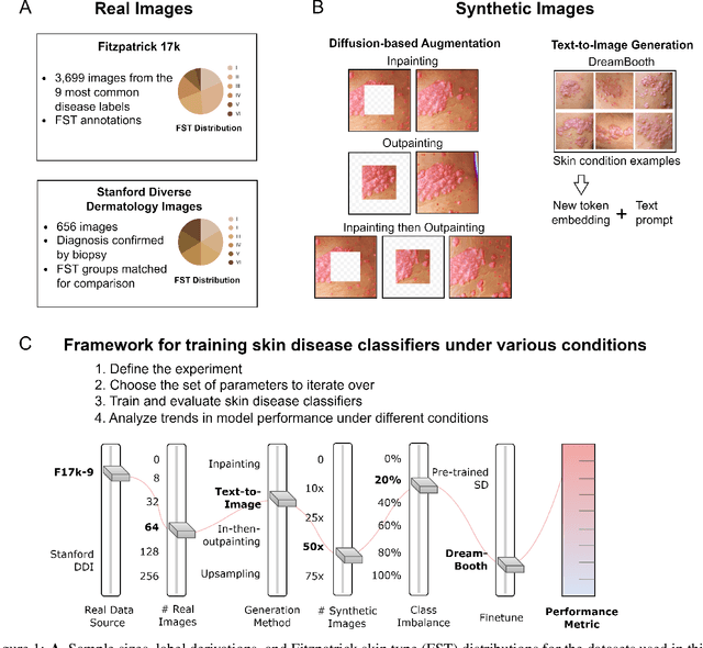 Figure 1 for Augmenting medical image classifiers with synthetic data from latent diffusion models