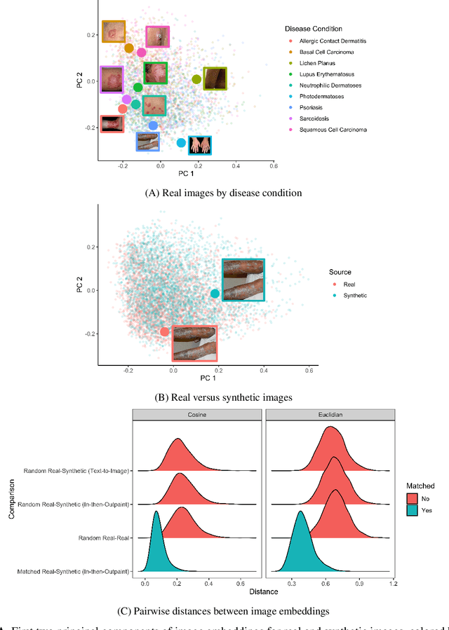 Figure 2 for Augmenting medical image classifiers with synthetic data from latent diffusion models