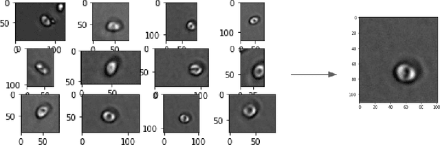 Figure 4 for A Novel Deep Learning based Model for Erythrocytes Classification and Quantification in Sickle Cell Disease