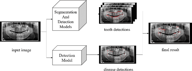 Figure 1 for Intergrated Segmentation and Detection Models for Dentex Challenge 2023