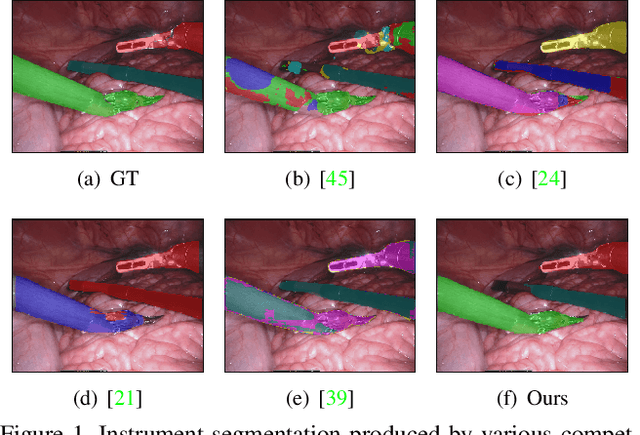 Figure 1 for From Forks to Forceps: A New Framework for Instance Segmentation of Surgical Instruments