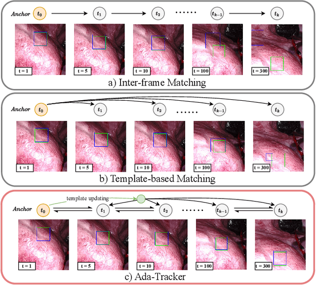 Figure 1 for Ada-Tracker: Soft Tissue Tracking via Inter-Frame and Adaptive-Template Matching