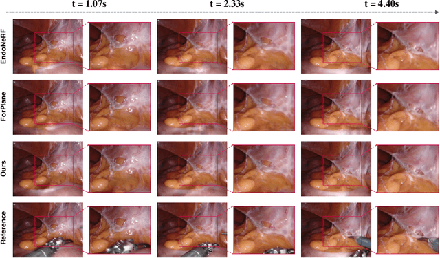 Figure 3 for Deformable Endoscopic Tissues Reconstruction with Gaussian Splatting