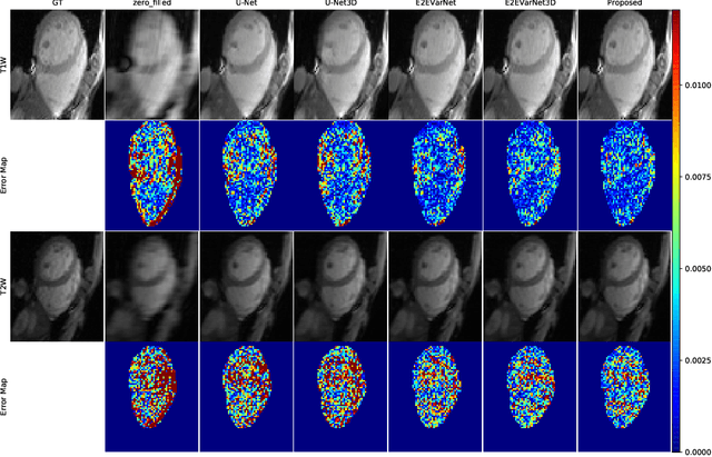 Figure 3 for $k$-$t$ CLAIR: Self-Consistency Guided Multi-Prior Learning for Dynamic Parallel MR Image Reconstruction