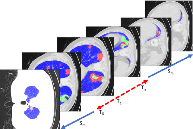 Figure 1 for NUMSnet: Nested-U Multi-class Segmentation network for 3D Medical Image Stacks