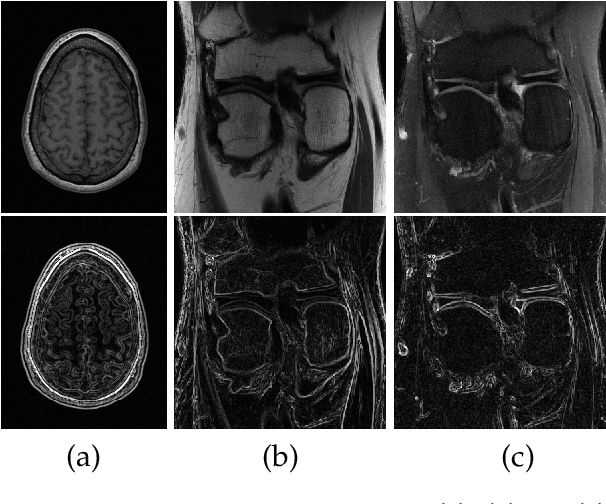 Figure 1 for Fast MRI Reconstruction via Edge Attention