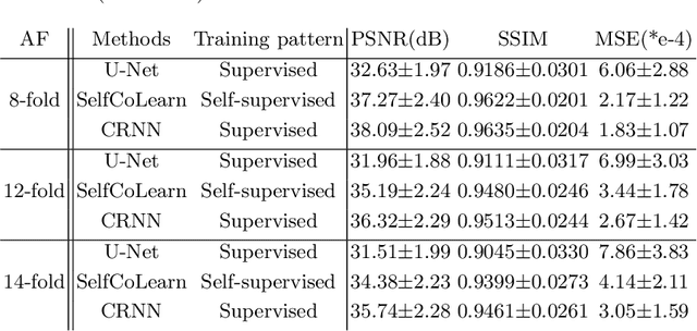 Figure 4 for SelfCoLearn: Self-supervised collaborative learning for accelerating dynamic MR imaging