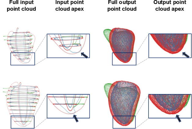 Figure 3 for Multi-class point cloud completion networks for 3D cardiac anatomy reconstruction from cine magnetic resonance images