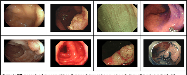 Figure 1 for Predicting Generalization of AI Colonoscopy Models to Unseen Data