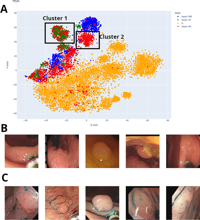 Figure 3 for Predicting Generalization of AI Colonoscopy Models to Unseen Data