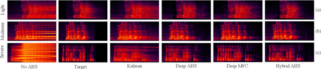 Figure 4 for Hybrid AHS: A Hybrid of Kalman Filter and Deep Learning for Acoustic Howling Suppression