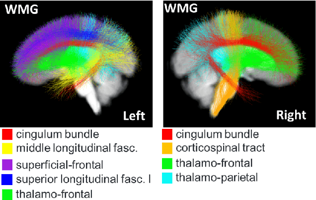 Figure 4 for TractGraphCNN: anatomically informed graph CNN for classification using diffusion MRI tractography