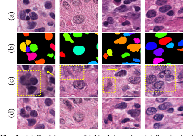 Figure 1 for Enhanced Sharp-GAN For Histopathology Image Synthesis