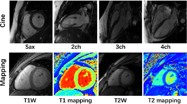Figure 2 for CMRxRecon: An open cardiac MRI dataset for the competition of accelerated image reconstruction