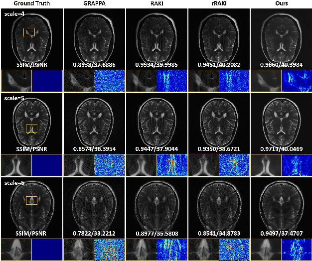 Figure 3 for Batch Implicit Neural Representation for MRI Parallel Reconstruction