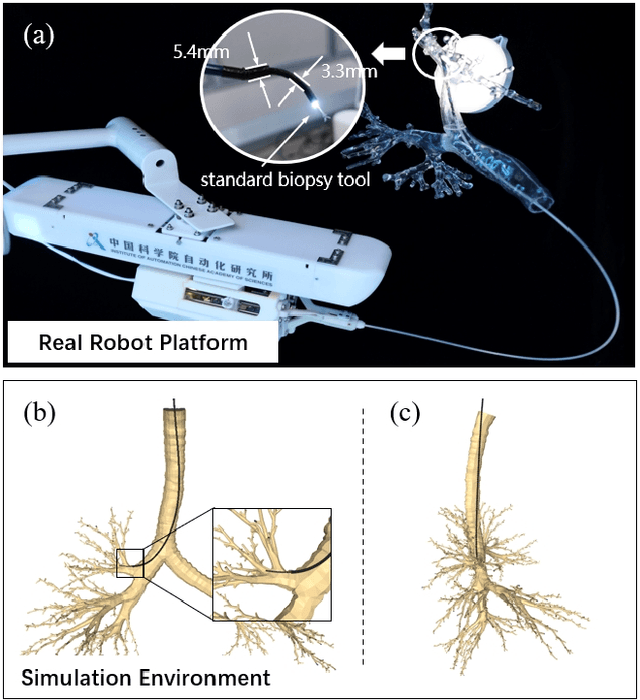 Figure 1 for BronchoCopilot: Towards Autonomous Robotic Bronchoscopy via Multimodal Reinforcement Learning