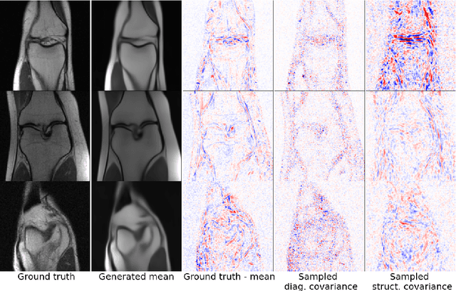 Figure 2 for Compressed Sensing MRI Reconstruction Regularized by VAEs with Structured Image Covariance