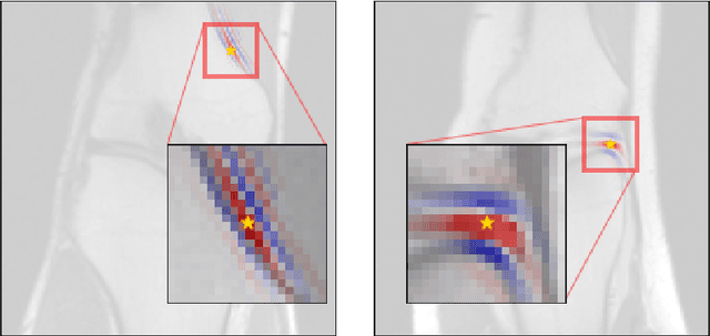 Figure 4 for Compressed Sensing MRI Reconstruction Regularized by VAEs with Structured Image Covariance