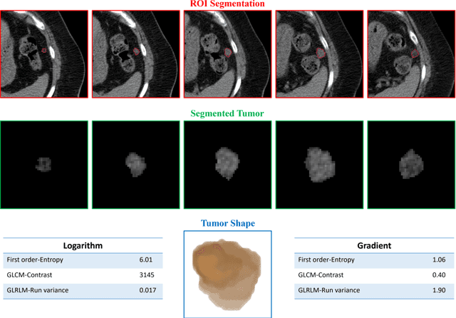 Figure 3 for Developing a Novel Image Marker to Predict the Responses of Neoadjuvant Chemotherapy (NACT) for Ovarian Cancer Patients