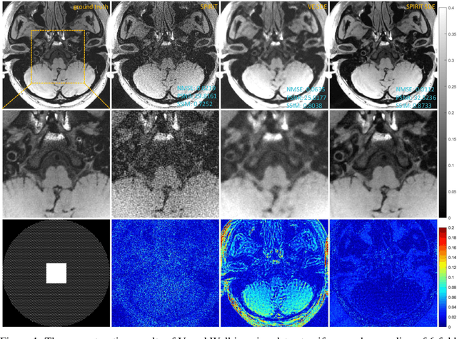 Figure 1 for SPIRiT-Diffusion: SPIRiT-driven Score-Based Generative Modeling for Vessel Wall imaging