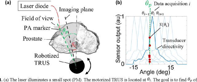 Figure 1 for Automatic Search for Photoacoustic Marker Using Automated Transrectal Ultrasound