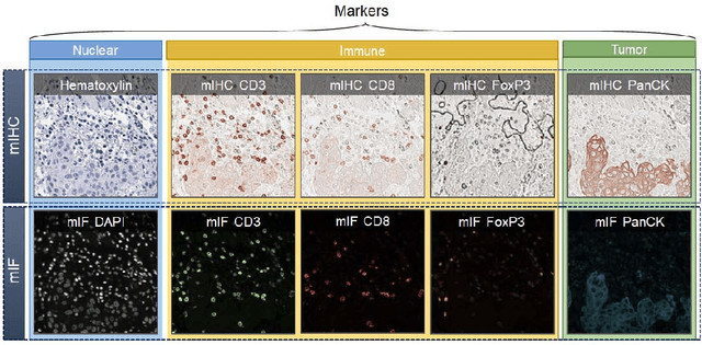 Figure 1 for An AI-Ready Multiplex Staining Dataset for Reproducible and Accurate Characterization of Tumor Immune Microenvironment