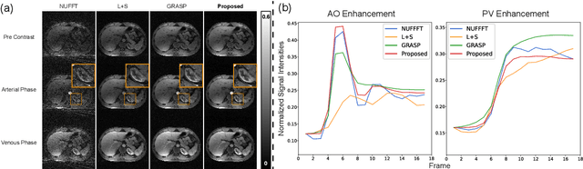 Figure 4 for Spatiotemporal implicit neural representation for unsupervised dynamic MRI reconstruction